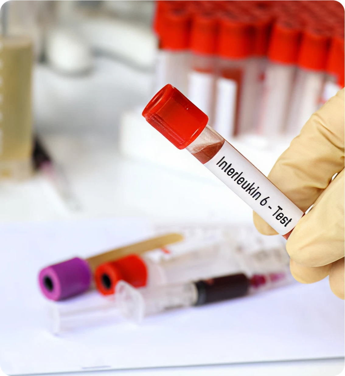 Accélération R&D — Agents IA & jumeaux numériques